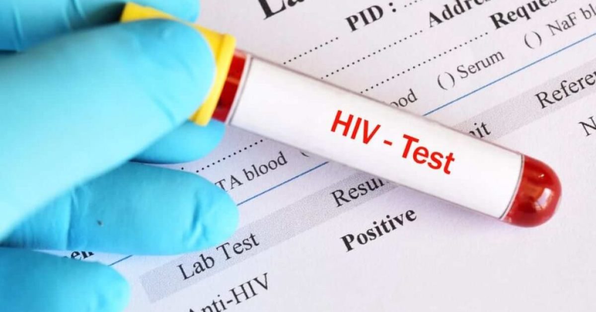 Dinkes Pangandaran Ungkap 47 Kasus HIV, Ditemukan dari Skrining Catin hingga Kelompok Berisiko
