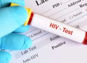 Dinkes Pangandaran Ungkap 47 Kasus HIV, Ditemukan dari Skrining Catin hingga Kelompok Berisiko